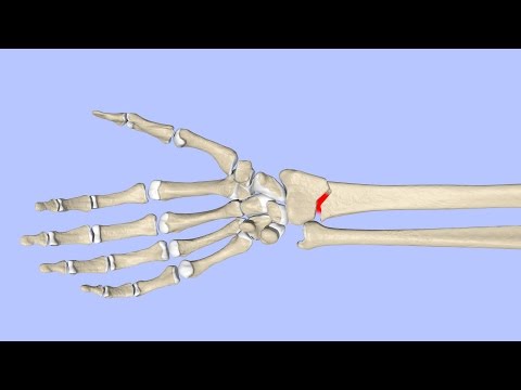 Principles of Fracture Healing