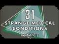 31 Strange Medical Conditions - Summer Bummer Series pt. 1 - mental_floss on YouTube (Ep.13)