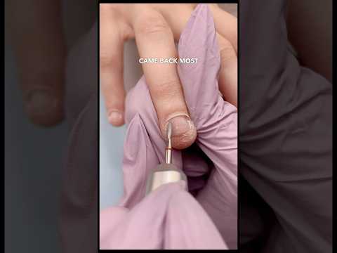 How to Grow Bitten Nails 💅