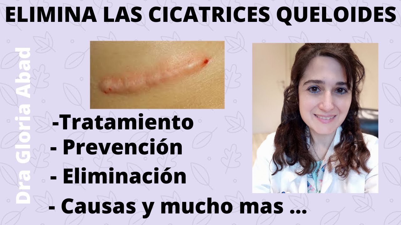 CICATRICES QUELOIDES ▶ Causas, prevención y tratamientos ✅