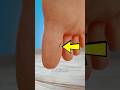 How To Remove A Splinter Without Pain Easy Method