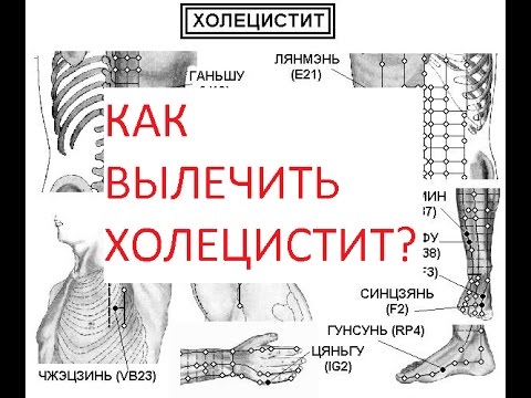 Рецепт для суставов с йодом и аспирином Лечения связок в локтевом суставе