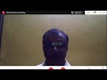 An Overview On Presence Of Zoonotic Importance Dr Placid E D Souza Part 2 Presentation