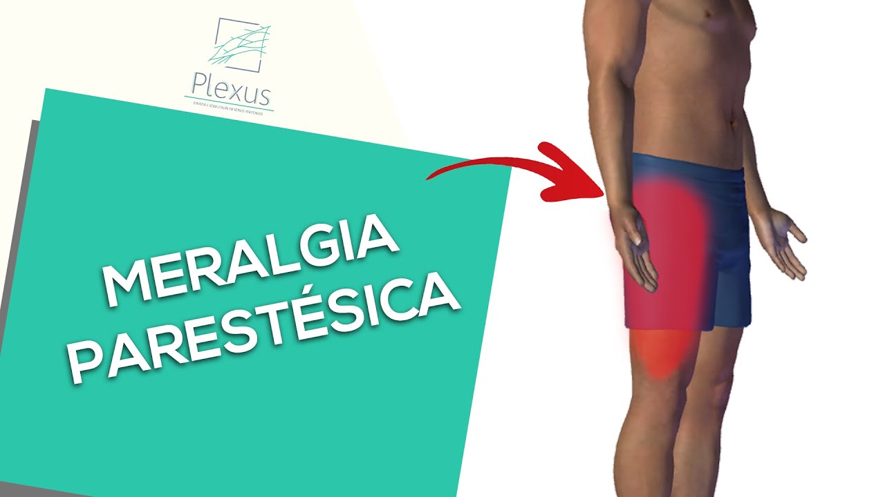 Meralgia parestésica