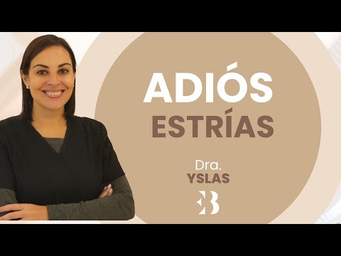 Estrias fuera