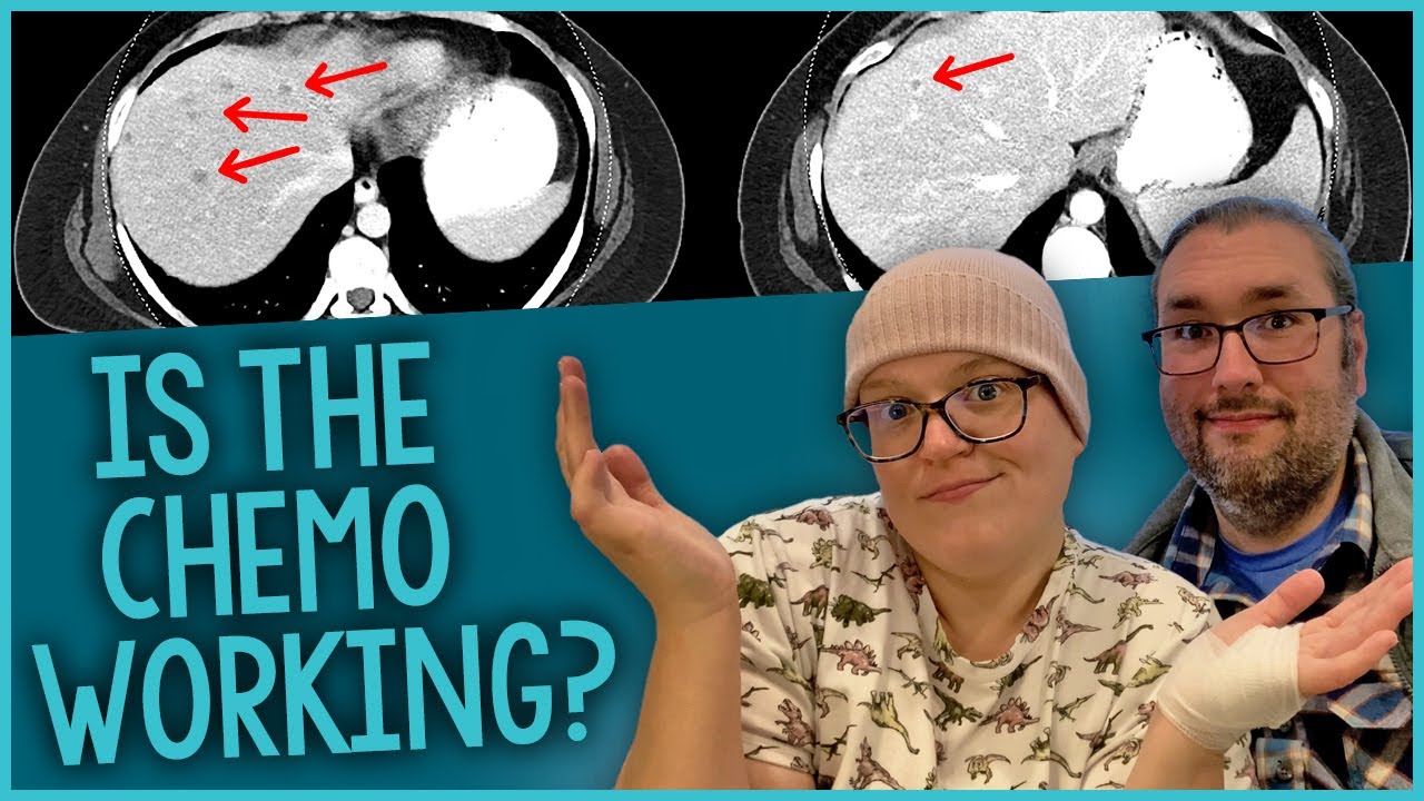 Is The Chemo Working? + What’s Next (Ovarian Cancer Stage 3 / 4)