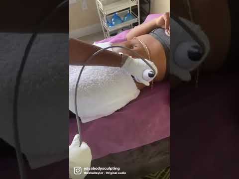 Body sculpting services are a safe and effective alternative to surgery with REAL results!