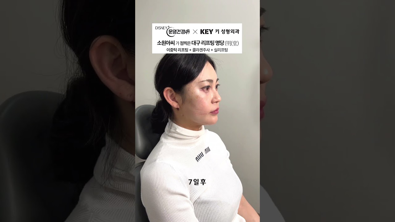 소원아씨가 점찍은 리프팅 명당