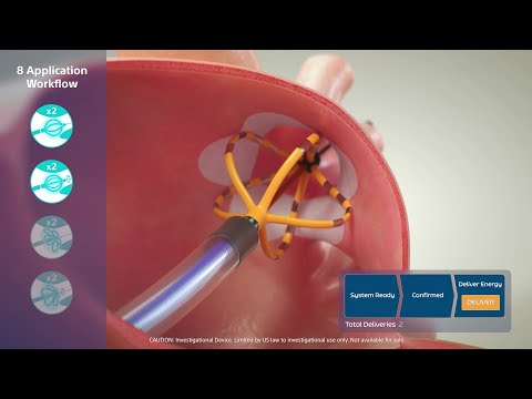 FARAPULSE™ Pulsed Field Ablation System: Workflow Introduction