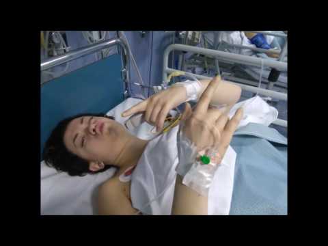 Quando le donne che allattano sono articolazioni dolenti Che di striscio al collo con osteocondrosi