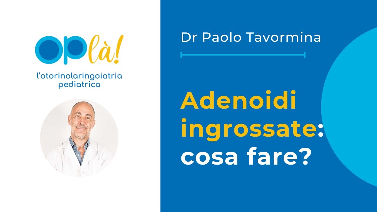 Adenoidi ingrossate nei bambini: cosa fare - Sintomi, diagnosi e terapia