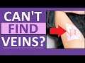 Hard to Find Veins Blood Draw, IVs, Venipuncture - Nursing, Phlebotomy Hard to Find Veins Blood Draw, IVs, Venipuncture - Nursing, Phlebotomy