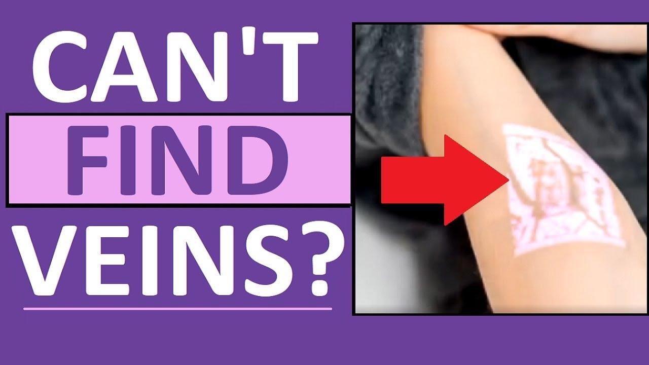 Hard to Find Veins Blood Draw, IVs, Venipuncture - Nursing, Phlebotomy