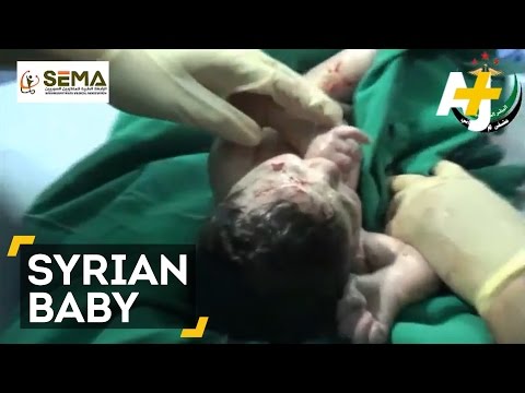Click to Watch the Syrian explosion horrifically sends shrapnel into pregnant mother's unborn baby video