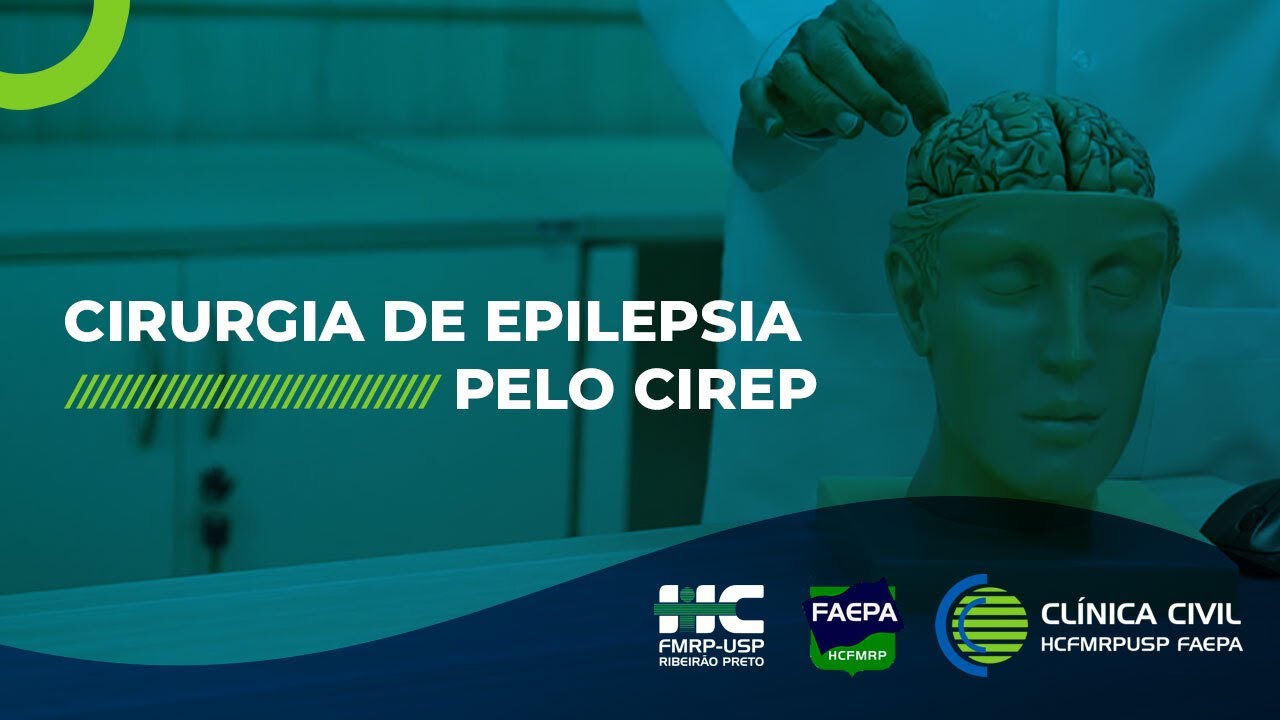 CIRURGIA DE EPILEPSIA PELO CIREP | Neurologia | Clínica Civil HCFMRP USP FAEPA