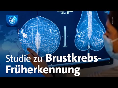 Studie zu Brustkrebs-Früherkennung
