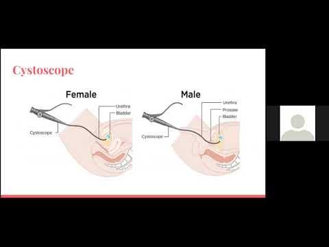 VMMC Campbell lecture series: Evaluation and management of hematuria