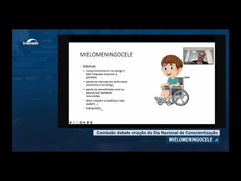 Debatedores pedem divulgação de tratamento para mielomeningocele no SUS