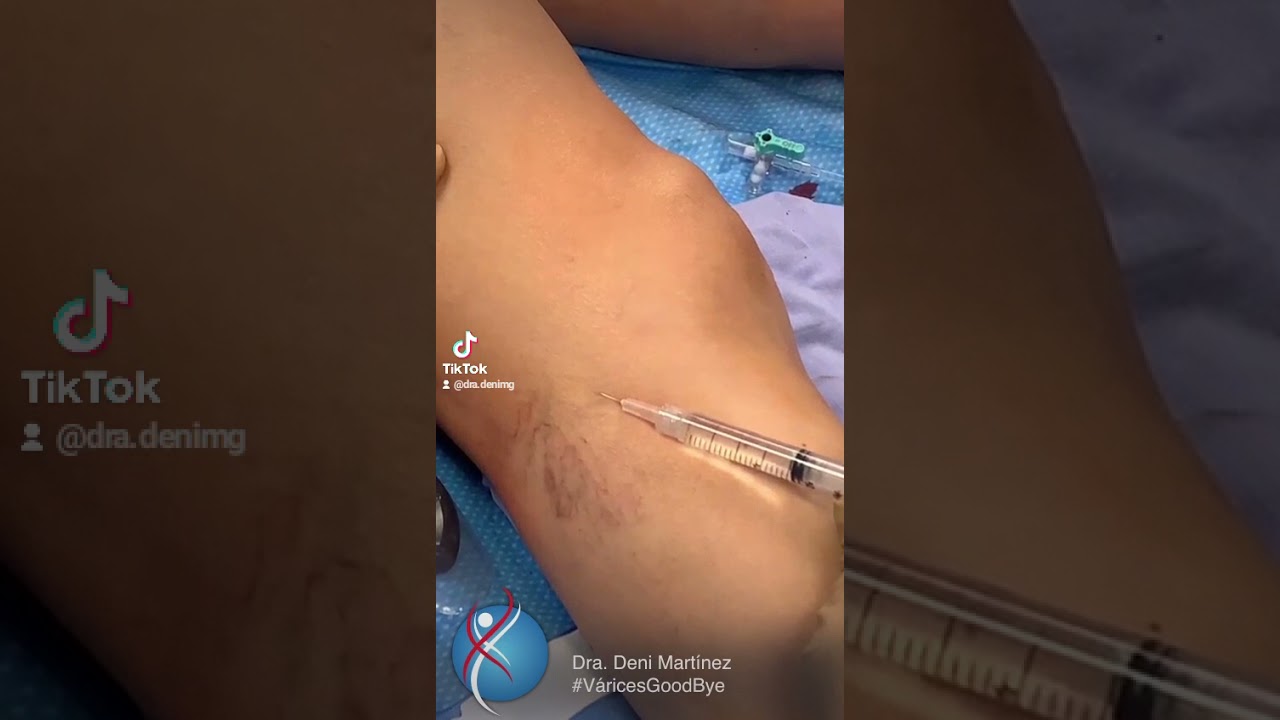 Deni Martínez Gama-25