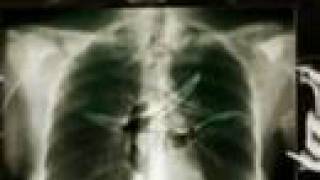 Sopor Aeternus - The Skeletal Garden