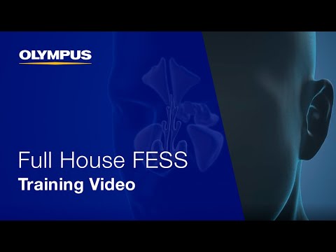 Full House FESS: Step-by-Step Training Video by Prof. Georgalas