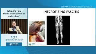 9th AMC Surgical Critical Care Symposium : When and How should source control be undertaken? 미리보기