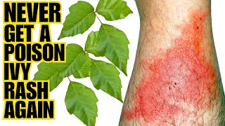 How To Never Get A SEVERE POISON IVY RASH | Q4 Method