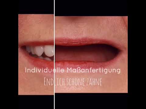 Teleskopprothese - Zahnarztpraxis Malte Schaefer