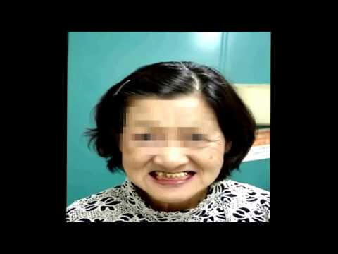 アンデルセン・タウィル症候群