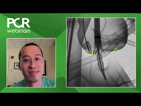 How can we optimise coronary access after TAVI? - Webinar