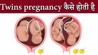 Twins pregnancy कैसे होती है I Twin pregnancy in Hindi I Twins baby I #twinspregnancy