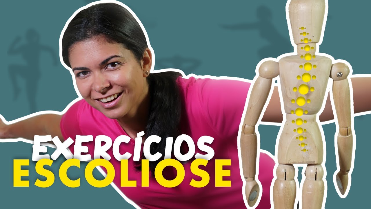 ESCOLIOSE - Exercícios para fazer em casa
