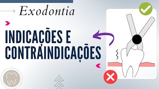 INDICAÇÕES E CONTRAINDICAÇÕES PARA EXODONTIAS