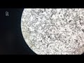 Aaltjes onder microscoop