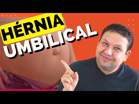 DOR NO UMBIGO?? HÉRNIA UMBILICAL !! Sintomas, causas e tratamento da hérnia umbilical.