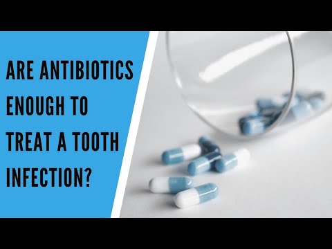 Are Antibiotics Enough To Treat A Tooth Infection?