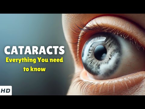 Cataracts Explained Simply – Types, Causes, Signs and Symptoms & Treatments