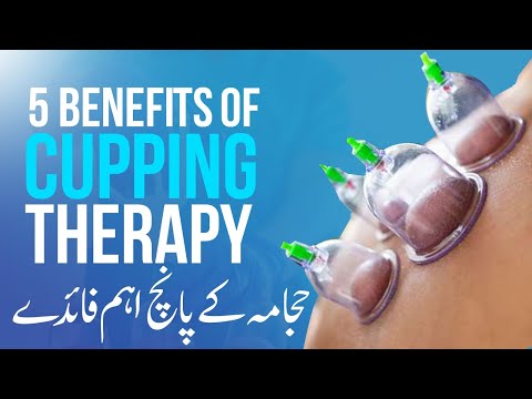Hijama Kya Hai? | Benefits of Cupping Therapy | Hijama K Fawaid | Hijama Therapy Kyun Karwana Chahie