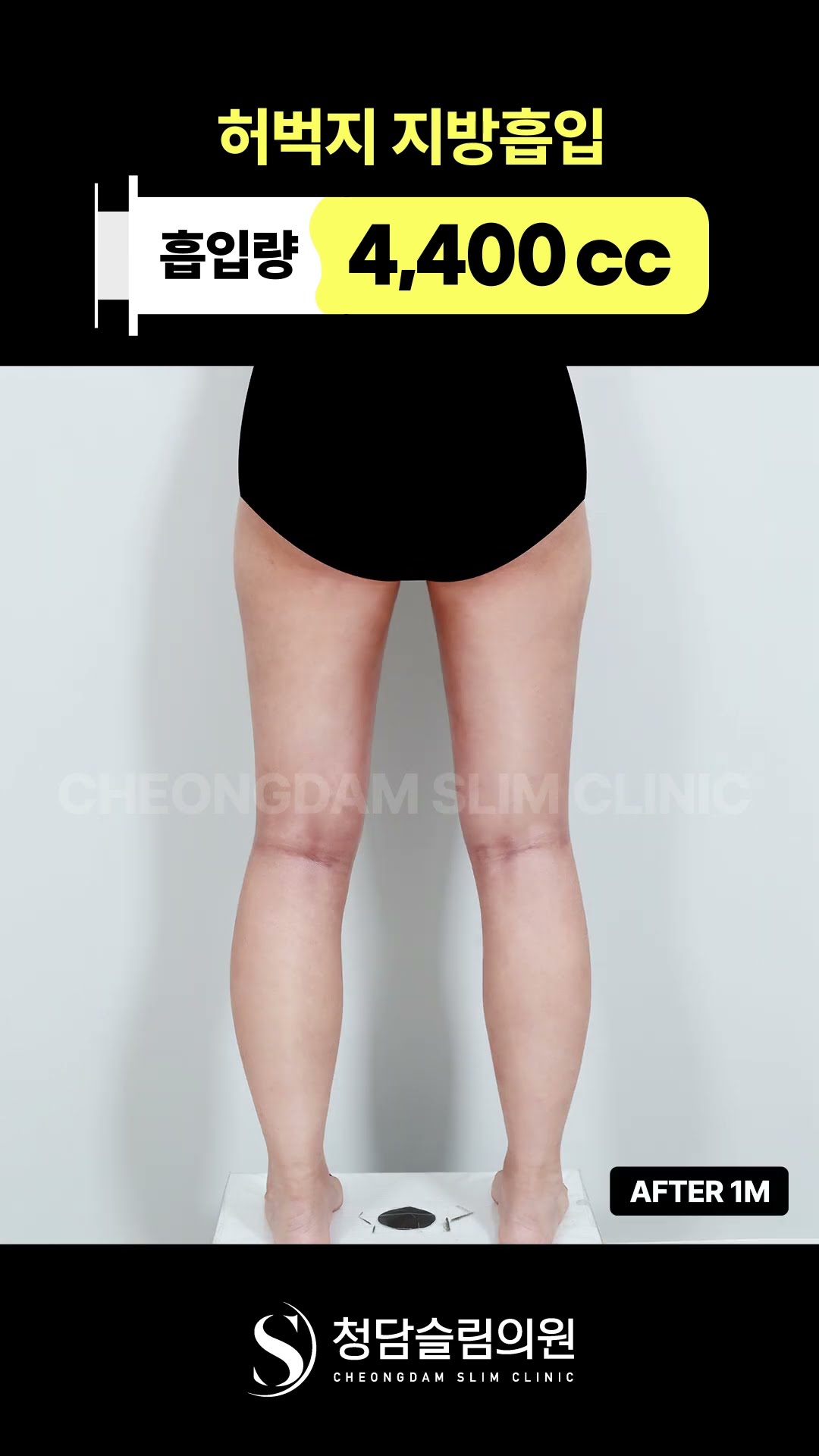 이 정도면 다른 다리 아님? 한달차 결과