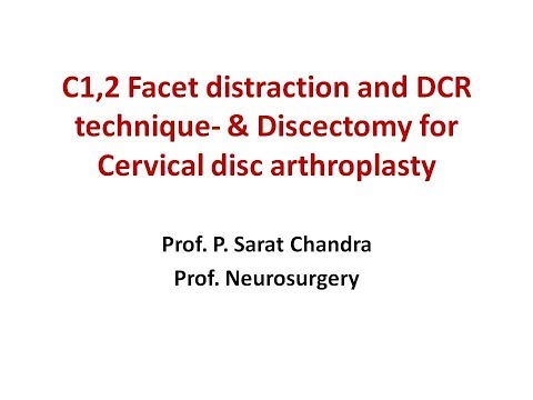 C1,2 Facet distraction and DCR technique  DemonstrationsProf  PS Chandra