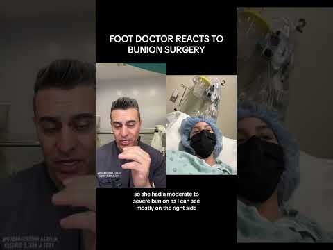 Minimally Invasive Bunion Surgery: A Foot Doctor's Reaction