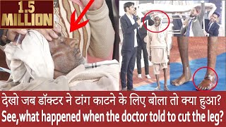देखो जब डॉक्टर ने टांग काटने के लिए बोला तो क्या हुआ video