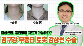 갑상선암의 흉터 없는 수술