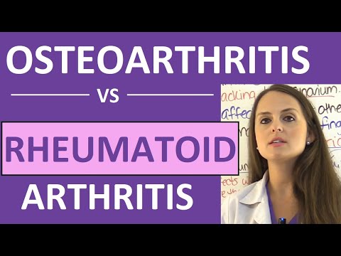 Osteoarthritis vs Rheumatoid Arthritis Nursing | Symptoms, Pathophysiology, Treatment Mnemonic NCLEX