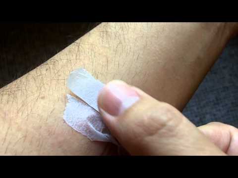 Improvise Butterfly Stitches Using Medical Tape