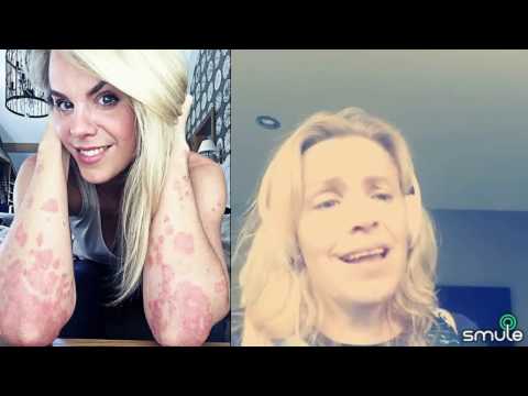 Die Mittel gegen die Schuppenflechte der Preis Die inguinale Schuppenflechte bei den Frauen des Fotos