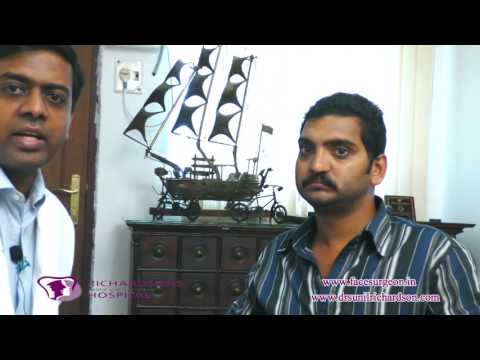 Before And After Moustache Transplant Surgery