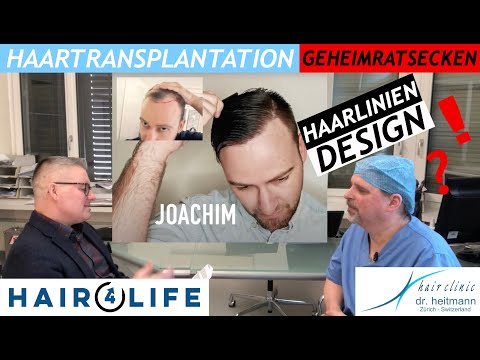 Haartransplantation Geheimratsecken, Haarlinie & Schläfen ► Was man wissen sollte! | Dr. Heitmann