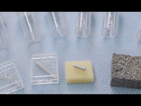 Smart implants dissolve after healing