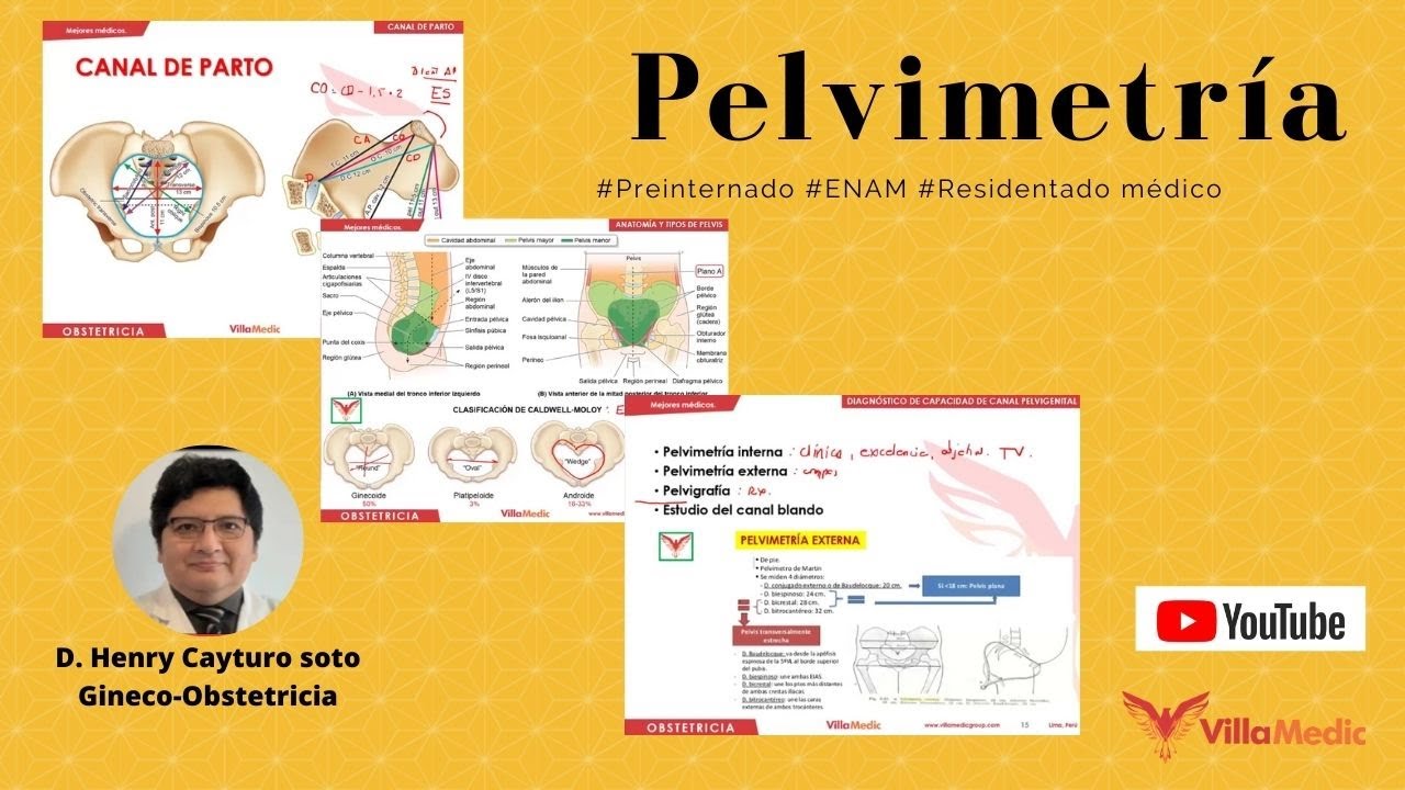 Pelvimetría: Un salvavidas de 18 minutos para tus exámenes.